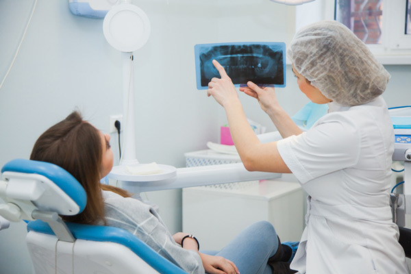 Dentist showing patient dental x-ray for dental implants at Pacific Oral & Facial Surgery Center in Livermore, CA